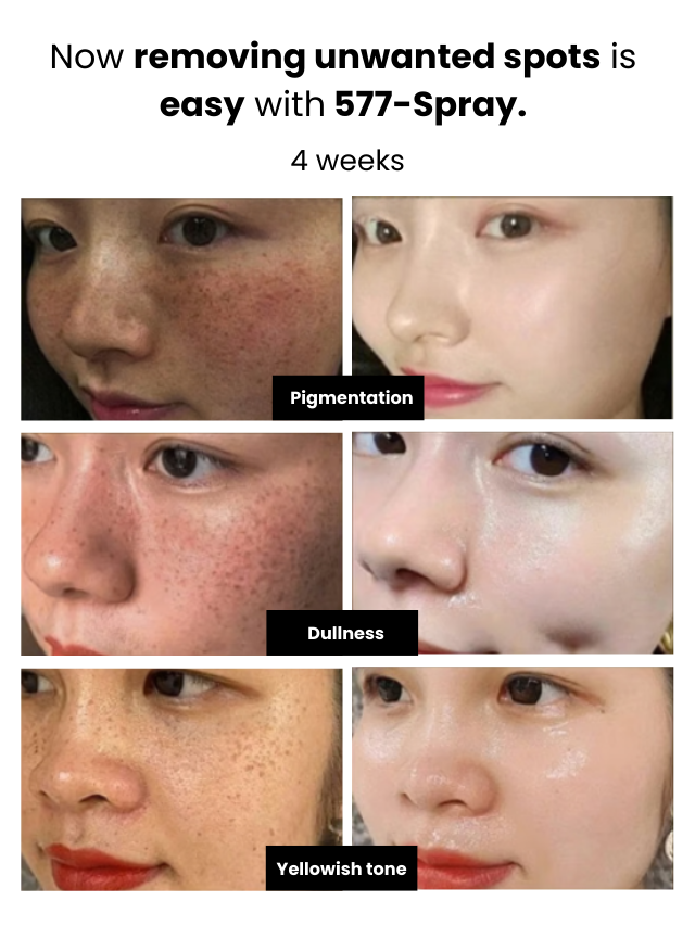 Dark Spot and Melasma Remover Spray 577