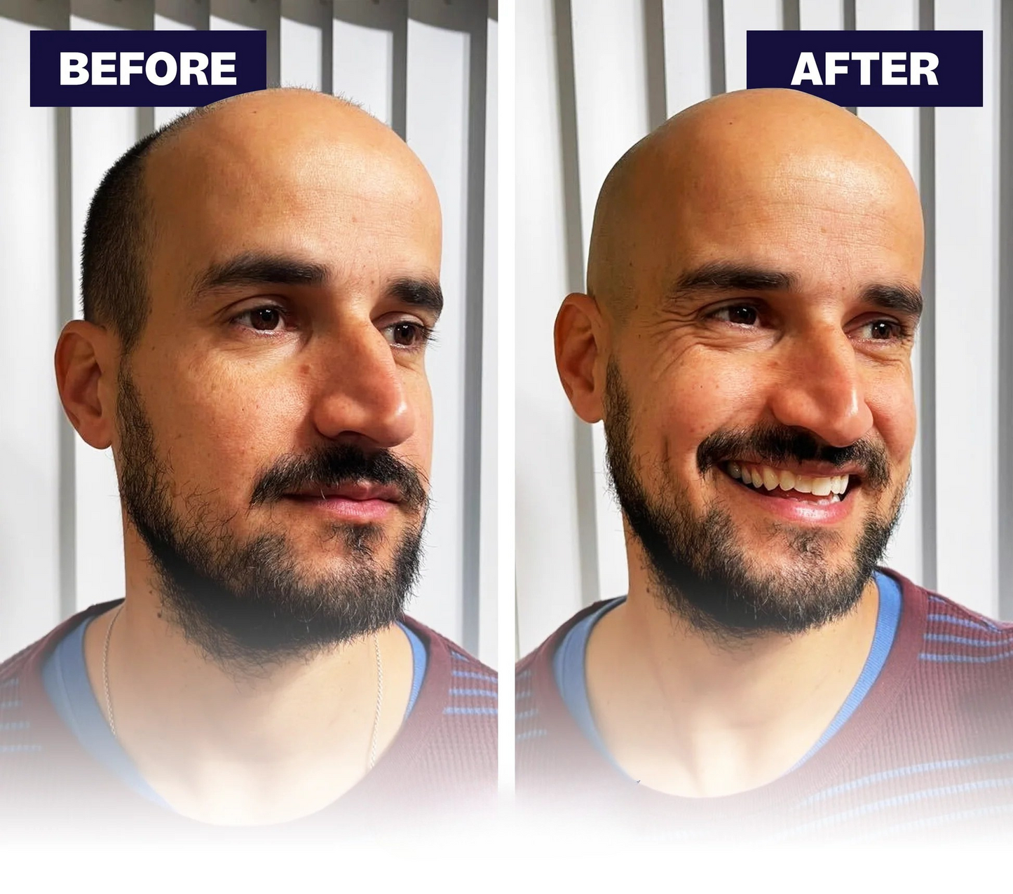 GlideFlex™ Grooming Kit + Free Shipping