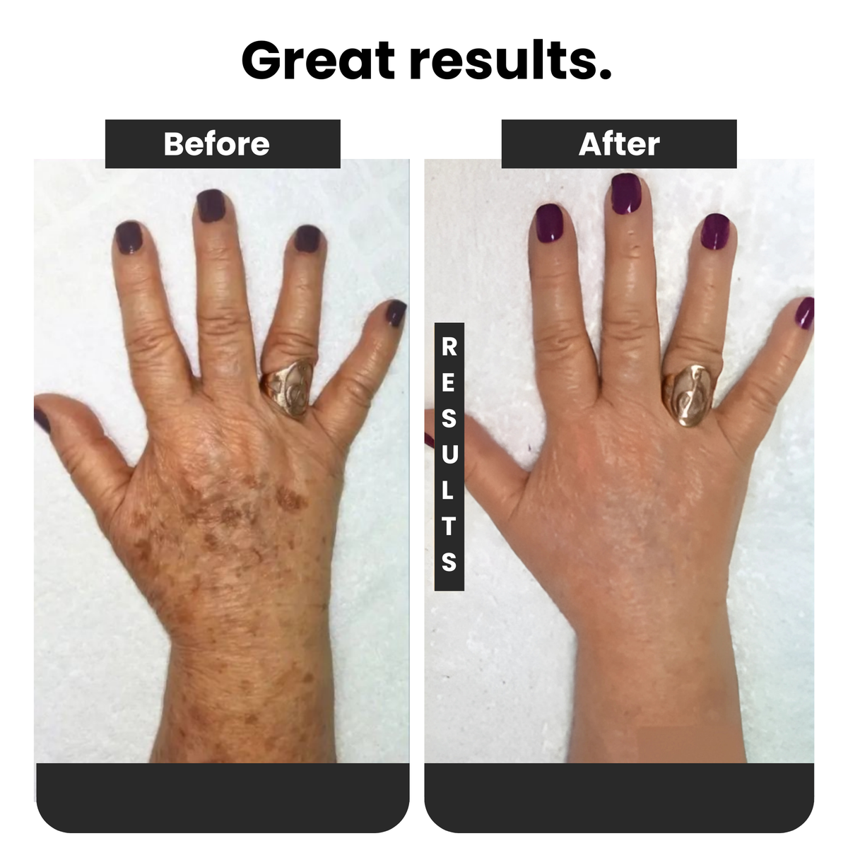 Spray 577 - Dark Spot Remover