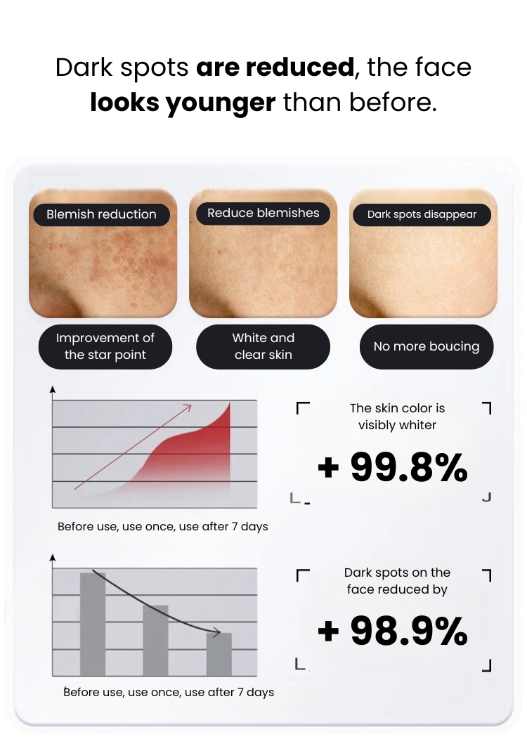 Spray 577 - Dark Spot Remover