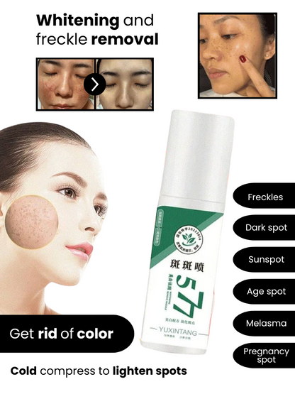 Spray 577 - Dark Spot Remover