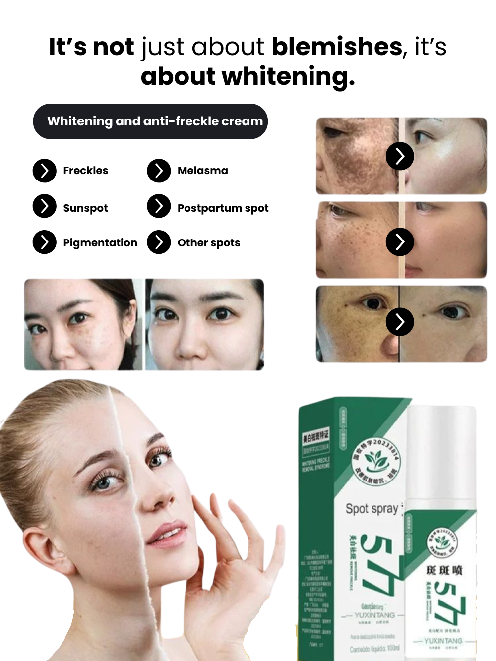 Spray 577 - Dark Spot Remover