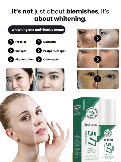 Spray 577 - Dark Spot Remover